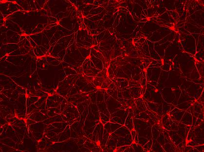 Image of red-labelled neurons Image of red-labelled neurons