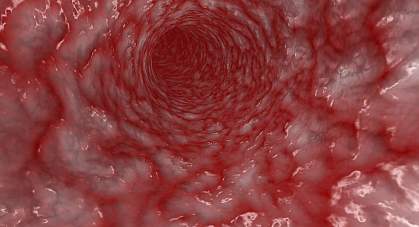 Image of the interior of an artery Image of the interior of an artery