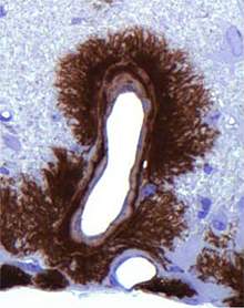 Microscopic image of dark staining surrounding an open space Microscopic image of dark staining surrounding an open space