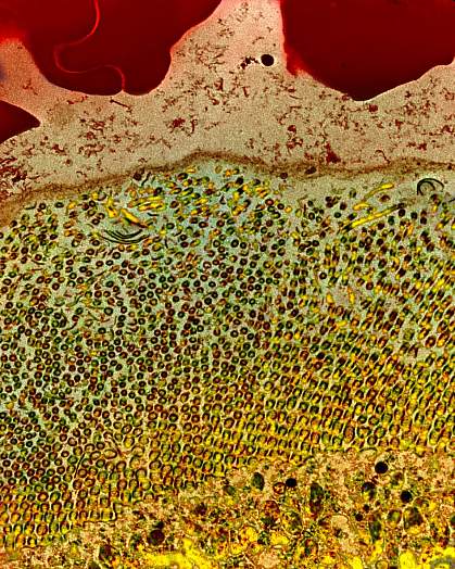 Microscopic image of a mosquito gut after a blood meal Microscopic image of a mosquito gut after a blood meal