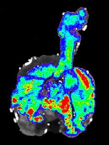 Image of mouse lung with brightly colored areas Image of mouse lung with brightly colored areas