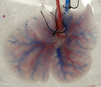 Photo of translucent liver with blue and red networks of blood vessels Photo of translucent liver with blue and red networks of blood vessels