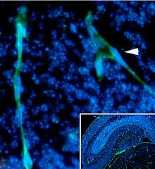 Microscopic image of hippocampus Microscopic image of hippocampus