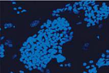 Microscope image of numerous round cells Microscope image of numerous round cells