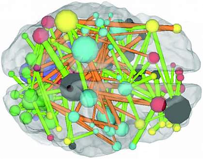 Schematic of a brain showing colorful connections within Schematic of a brain showing colorful connections within