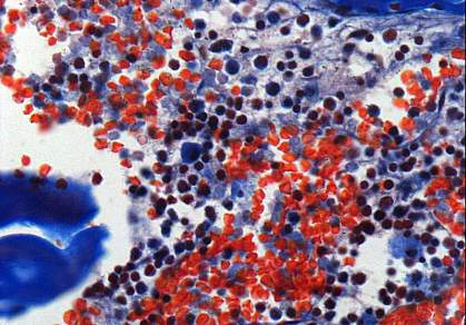 Microscopic image of blood cells in bone marrow