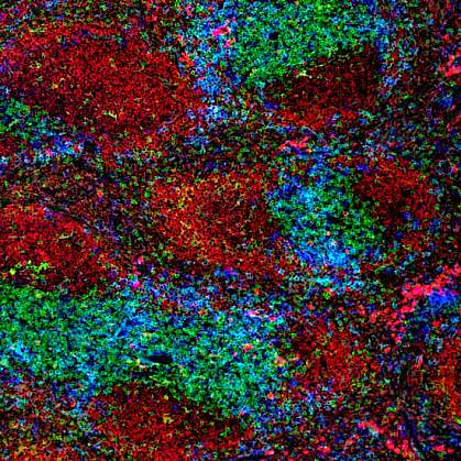 Microscope image of red, green and blue cells in a mouse spleen Microscope image of red, green and blue cells in a mouse spleen