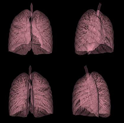 CT scan of a human lung CT scan of a human lung