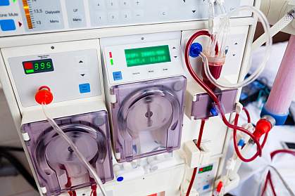 Photo of dialysis equipment Photo of dialysis equipment