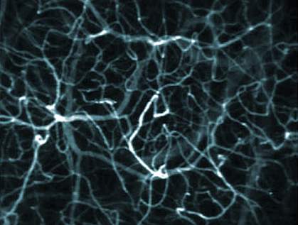 Microscope image of a blood vessel network Microscope image of a blood vessel network