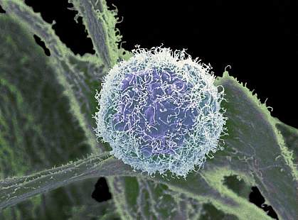 Electron micrograph of a round cell with stringy filaments on its surface Electron micrograph of a round cell with stringy filaments on its surface