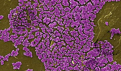 Scanning electron microscope image showing lumps of purple spherical bacteria Scanning electron microscope image showing lumps of purple spherical bacteria
