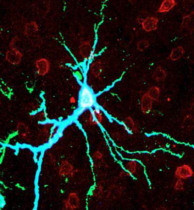 Microscope image of intense blue neuron Microscope image of intense blue neuron.