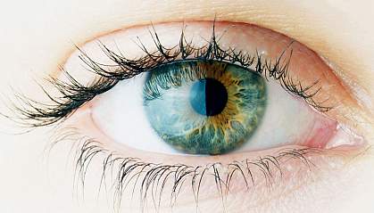 Photo of an eye Photo of an eye
