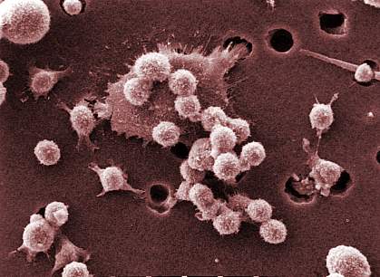 Microscope image of several small round cells on a larger, spiky cell. Microscope image of several small round cells on a larger, spiky cell.