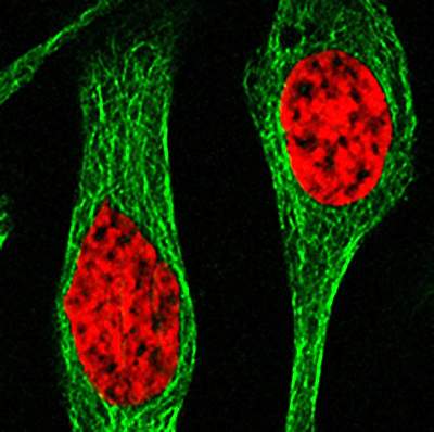 Microscope image of red circular areas in 2 cells Microscope image of red circular areas in 2 cells