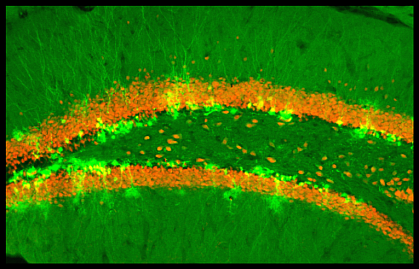 Microscope image shows bright green splotches near thick orange lines Microscope image shows bright green splotches near thick orange lines.