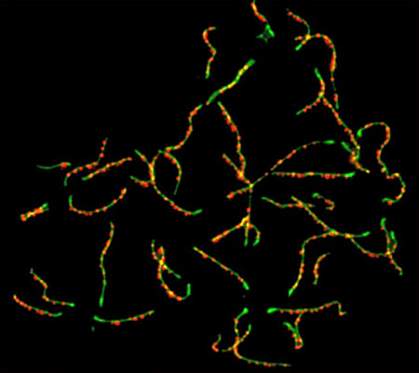 Microscope image of green chromosomes dotted with red spots Microscope image of green chromosomes dotted with red spots