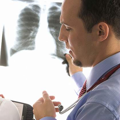 Photo of doctors looking at an x-ray cropped Photo of doctors looking at an x-ray cropped