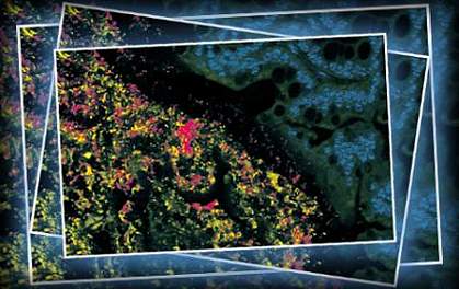 Microscope image of microbes on intestine surface Microscope image of microbes on intestine surface