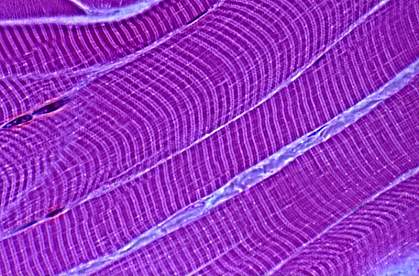 Microscopic image of striped muscle fibers. Microscopic image of striped muscle fibers.