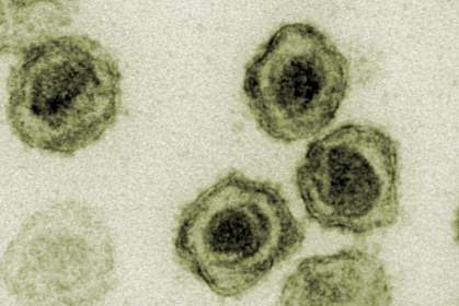 Transmission electron micrograph of round virus particles Transmission electron micrograph of round virus particles