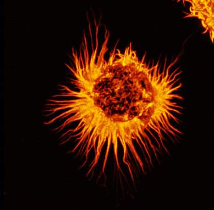 Micrograph of a round cell with many long and slender protrusions Micrograph of a round cell with many long and slender protrusions