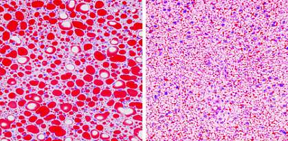 Right panel shows photo of fat tissue with large, bright red droplets; left panel shows fat tissue with small, scattered droplets. Right panel shows photo of fat tissue with large, bright red droplets; left panel shows fat tissue with small, scattered droplets.