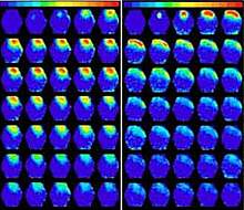 Photo of numerous images of mouse brains, with more on the left showing yellow and red areas. Photo of numerous images of mouse brains, with more on the left showing yellow and red areas.
