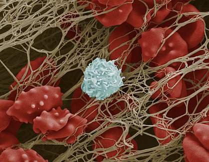 Scanning electron micrograph of blood cells trapped in a fibrous mesh Scanning electron micrograph of blood cells trapped in a fibrous mesh