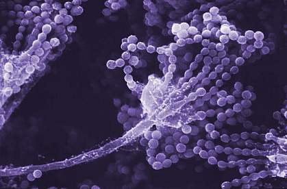 Scanning electron micrograph showing a long stalk with multiple beaded strands at the tip Scanning electron micrograph showing a long stalk with multiple beaded strands at the tip.