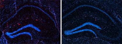 Two similar microscope images, with more red spots in the left one Two similar microscope images, with more red spots in the left one.