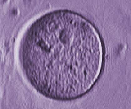 Oocyte Oocyte.