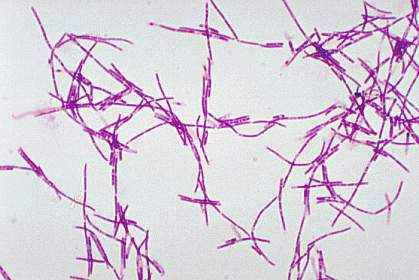Chains of long, thin bacterial cells Chains of long, thin bacterial cells.
