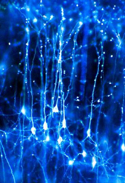 Network of branched neurons Network of branched neurons.