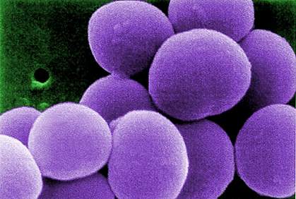 Staphylococcus bacteria Staphylococcus bacteria.