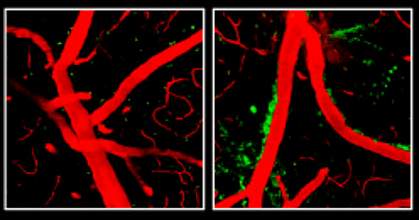 Blood vessels in the blood-brain barrier.