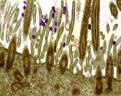 Electron micrograph showing several rod-shaped viruses on surface of long cells.