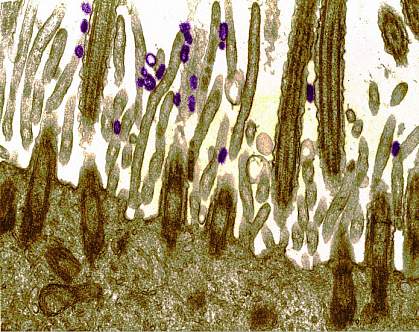 Electron micrograph showing several rod-shaped viruses on surface of long cells Electron micrograph showing several rod-shaped viruses on surface of long cells.