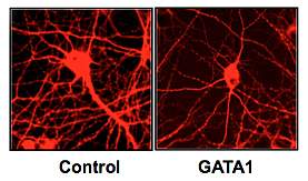 Microscope images of cultured rat neurons.