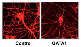 Microscope images of cultured rat neurons Microscope images of cultured rat neurons.