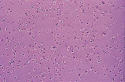 Microscope image of capsule-shaped bacteria Microscope image of capsule-shaped bacteria.