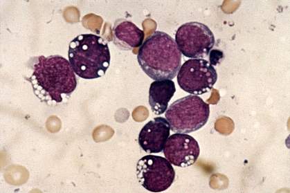 Round cells Round cells.