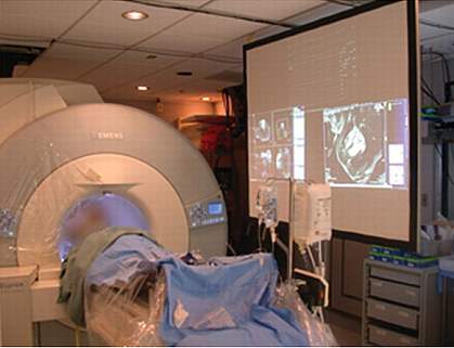 MRI system MRI system.