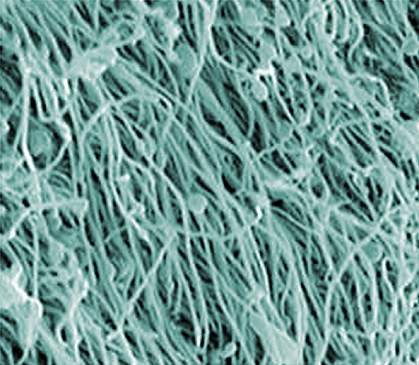 Scanning electron micrograph of cilia Scanning electron micrograph of cilia.