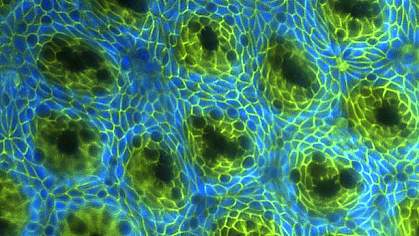 Microscope image shows intestinal lining with areas of dark green cells Microscope image shows intestinal lining with areas of dark green cells.
