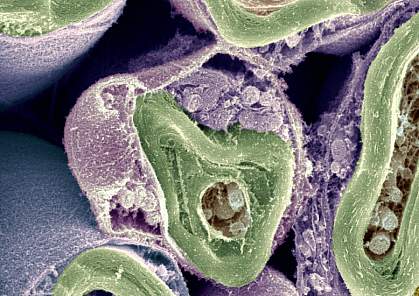 Cross-section of a nerve fiber.