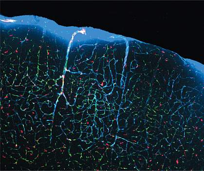 Fluid flowing through channels in the brain Fluid flowing through channels in the brain.