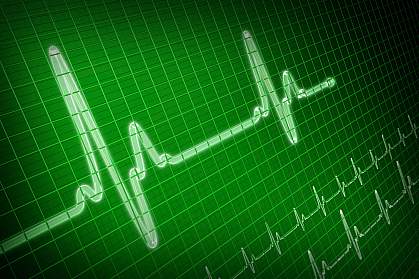 Photo of electrocardiogram showing a heart pulse. Photo of electrocardiogram showing a heart pulse.