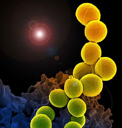 Illustration of several round bacteria on the surface of a white blood cell Illustration of several round bacteria on the surface of a white blood cell